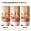 Dermatix Silicone Scar Gel Professional Scar Treatment for Surgery, Burns & Injuries Clinically Proven to Reduce the Appearance of Scars Smooths & Improves Skin 60 g view 4