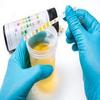 10 Parameter Urine Strips Dipstick Tests 100 Test Strips - pH, Glucose, Ketone, Liver, Kidney view 4