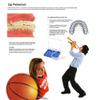 Our Bestseller Orthodontic Braces Lipguard Protector Shield (1 set - Upper - Lower teeth) by Orthomechanics view 4