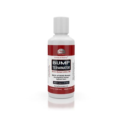 Bump Terminator Severe Bumps Lotion (120ml)