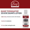 Bump Terminator Severe Bumps Lotion (120ml) view 2