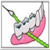 IDontix Brace X-Floss, Green view 4