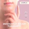 Bapscarcare Silicone Scar Gel | Ideal Scar Treatment for Face, Neck, and Hand Scars | Effective on Old and New Scars | Non-Sticky & Non-Greasy | 20g view 4
