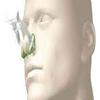 MYAID RhinoPinch Nasal/Nose Clips, First Aid for Nose Bleeds (Epistaxis) - Pack of 5 view 4