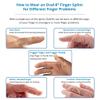 3 Point Products Oval-8 Finger Splint Refill, Size 13, 0.6 Ounce view 2