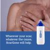 ScarGone Scar Minimising Massager  Effective Treatment for Face & Body, Targets Keloid, Acne, Burn, Dark, and Surgical Scarring  Reduces Appearance of New & Old Wounds view 2