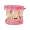 Dentalmall 1 Pc Dental Implant Study Analysis Demonstration Teeth Model #2001 with Restoration Pink view 1