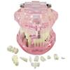 Dentalmall 1 Pc Dental Implant Study Analysis Demonstration Teeth Model #2001 with Restoration Pink view 2