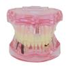 Dentalmall 1 Pc Dental Implant Study Analysis Demonstration Teeth Model #2001 with Restoration Pink view 3