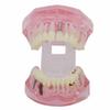 Dentalmall 1 Pc Dental Implant Study Analysis Demonstration Teeth Model #2001 with Restoration Pink view 4