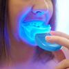 at-Home Teeth Whitening Light Accelerator with Matched Mouth Tray - Grinigh - Powerful 5 LED Tubes for Teeth Whitening Treatment (Batteries Included)- Blue view 2