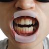 Earlywish 4pcs Dental Orthodontic Intraoral Mouth Cheek Lip Retractor Openers Round, O Shape Fun Game Tool view 4