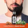 The Man Company 100% Natural Beard Oil for Men with Almond Oil, Thyme, Argan, and Jojoba Oil for Faster Beard Growth - 1.1 Oz | Beard Conditioner Oil, Softens & Strengthens Beards and Mustaches view 3