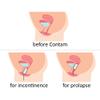 Contam Large Vaginal Pessary Starter Set view 3