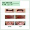 CREADENT Kit for replacing a missing tooth with a temporary cosmetic tooth view 4