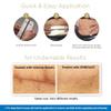 Embrace Active Scar Defense for New Scars, FDA-Cleared Silicone Scar Sheets, 4.7 Inch, Large, 30 Day Supply view 3