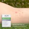 Molutrex Molluscum Contagiosum Treatment, 3ml view 2
