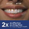 Waterpik Ultra Professional Water Flosser, 5 Tips, Advanced Pressure Control System, 10 Settings, Dental Plaque Removal Tool, Black, WP-662UK, 2pin UK Bathroom Plug view 3