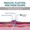 Epi-Derm C-Strip - 1.4 x 6 in - (5 Pack) (Clear) Silicone Scar Sheets from Biodermis view 4