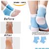 10PCS of Heel Socks for Dry Hard Cracked Skin by PEDIMEND - Moisturizing Socks - Reduce Pressure and Friction - Plantar Fasciitis Relief Foot Sleeve - Unisex- Foot Care view 1