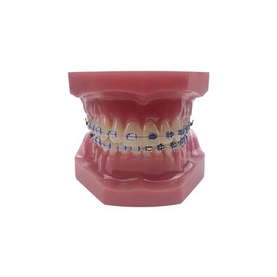 YOUYA Dental TM-208 Demonstration Orthodontic Model Teeth Teach Study Tools with Metal and Ceramic Bracket(Red)