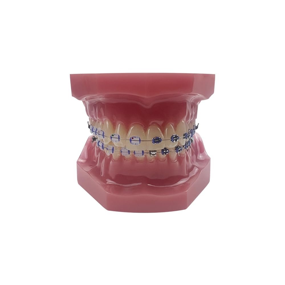 YOUYA Dental TM-208 Demonstration Orthodontic Model Teeth Teach Study Tools with Metal and Ceramic Bracket(Red)
