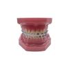 YOUYA Dental TM-208 Demonstration Orthodontic Model Teeth Teach Study Tools with Metal and Ceramic Bracket(Red) view 1