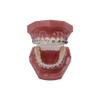 YOUYA Dental TM-208 Demonstration Orthodontic Model Teeth Teach Study Tools with Metal and Ceramic Bracket(Red) view 2