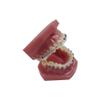 YOUYA Dental TM-208 Demonstration Orthodontic Model Teeth Teach Study Tools with Metal and Ceramic Bracket(Red) view 4