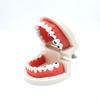 Airgoesin Dental Standard Teeth Study Teaching Model Kids Patient Education Caries Treatment Decayed Tooth Model view 1
