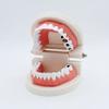 Airgoesin Dental Standard Teeth Study Teaching Model Kids Patient Education Caries Treatment Decayed Tooth Model view 2