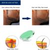 Exfoliating brush to treat And prevent razor bumps And ingrown hairs-including tweezers-eliminate shaving irritation For Face, Armpit, Legs, Bikini line-solution For Men And Women by Silky Skin view 2