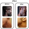 Exfoliating brush to treat And prevent razor bumps And ingrown hairs-including tweezers-eliminate shaving irritation For Face, Armpit, Legs, Bikini line-solution For Men And Women by Silky Skin view 3