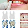 100 pcs Temporary Teeth Crown Resin Materials Realistic Oral Care Anterior Posterior Molar Crown view 2