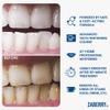 ZABERRY Teeth Whitening Kit, LED Laser Light Activator, 6X3ml Premium Whitening Gels, Full Tooth Whitening Course, Sensitivity-Free and Enamel Safe view 2