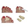 3pp Toe Loops  Provides Cushioned Relief for Hammertoes, Claw Toes, Overlapping Toes and Fractures. Narrow and Wide Available. Sold Individually 1 per Pack. (Wide 3.1 cm) view 2