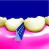 Piksters Pikstix Toothpicks for Plaque Removal, Pack of 30 view 4