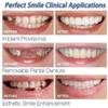 1 Pair Temporary Cosmetic Teeth Denture Teeth Cosmetic Simulated Braces Upper Braces + Lower Braces, Whitening Teeth Snap Cap On Instant Comfortable Flex Perfect Veneers view 2