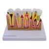 HeineScientific 2-Piece Model of Dental Damage and Sicks view 1