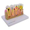 HeineScientific 2-Piece Model of Dental Damage and Sicks view 3