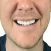 Instant Smile Comfort Fit Flex Cosmetic Upper Teeth, Natural Shade, Comfortable Upper Veneer for Extended Wear, Teeth Veneers for Men and Women, 1 Size Fits Most view 2