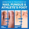 Athletes Foot Shoe Spray for Fungal Nail Treatment | Athletes Foot & Anti Toe Nail Fungus Treatment and Foot Fungus | Ringworm Foot Care Shoe Freshener | 150 ML view 3