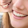 Temporary Tooth Repair Kit Instant Perfect Smile False Teeth Adhesive for Missing Tooth Replacement, 5 PCS,Darkshade5PCS view 2