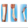 Fortuna 1m Tubular Bandage (C) view 1