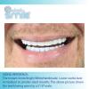 Instant Smile Handmade Cosmetic Lower Teeth, Bright White Shade, Comfortable Lower Veneer for Extended Wear, Teeth Veneers for Men and Women, 1 Size Fits Most view 3