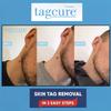 Tagcure Skin Tags Remover Kit for Easy Wart, Mole & Skin Tag Removal at Home (2. 'Plus' Device (Suitable for Skintags 0.5cm or Larger)) view 2