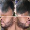 Beard Pen Filler for Men - Barber Styling Grooming Pencil with Brush - Waterproof Proof, Sweat Proof, Long Lasting Solution with Natural Finish - Cover Beard and Scalp Patches - Black 1 Pack view 2