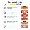 Whites Beaconsfield Teeth Whitening Strips, 28 Strips (14-Day Treatment)  Non-Peroxide Formula, Enamel-Safe, Brighten Teeth Fast, Removes Coffee, Wine, Smoke Stains, Safe for Sensitive Teeth view 2