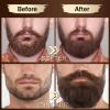 Beard Growth Kit w/Beard Wash,2 Pack Beard Growth Serum,Beard Growth Oil,Beard Balm,Comb,Brush,Scissor,Bag,E-Book,Beard Care Grooming Kit Christmas Stocking Fillers Gifts for Men Him Dad Husband view 2
