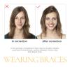 2 Pcs Aligner Chewies for Invisalign Trays, Aligner Tray Seaters, Teeth Chewies, Jaw Exerciser, Use for Oral Care Dental Mouth Health view 4